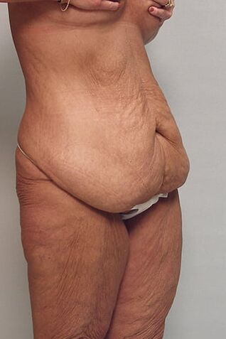 Bodies to excite