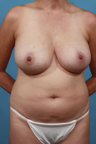Bodies to excite