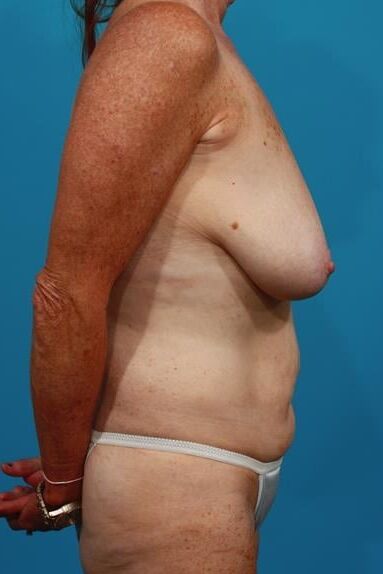 Bodies to excite