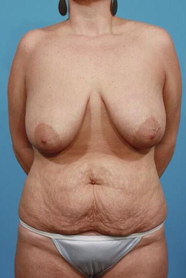 Bodies to excite