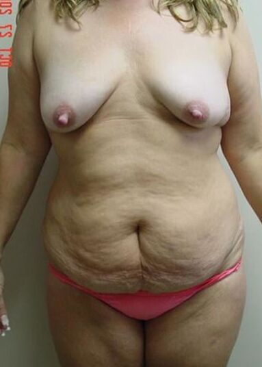 Bodies to excite