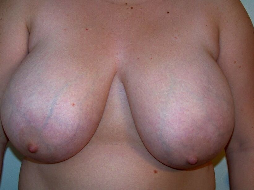 Bodies to excite
