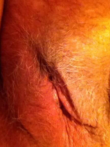 hairy