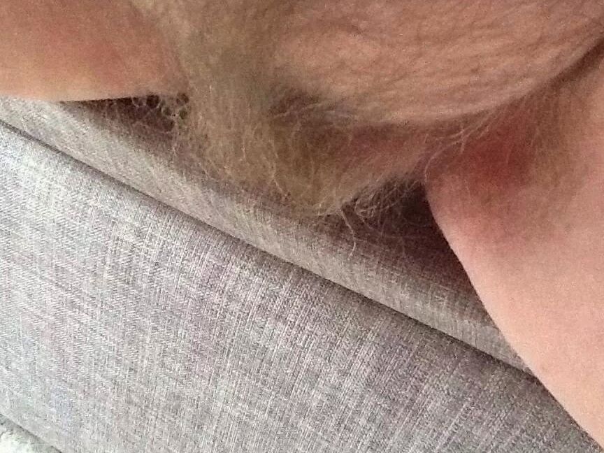 hairy