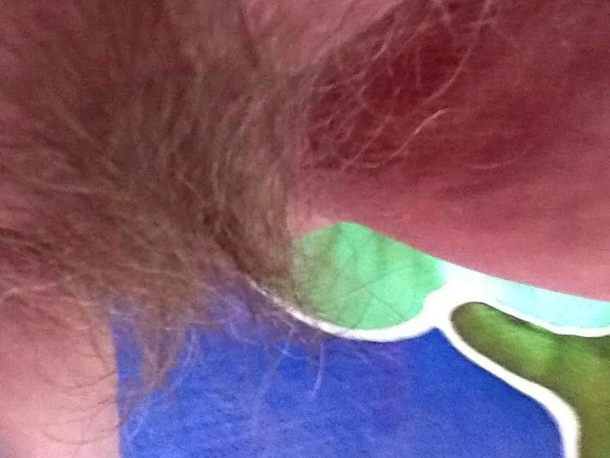 hairy