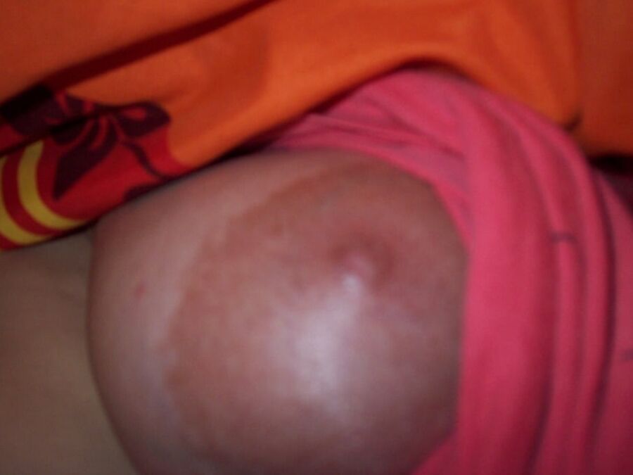 Nipples