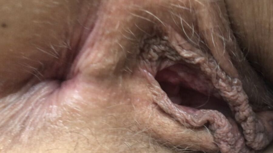 Upclose assholes