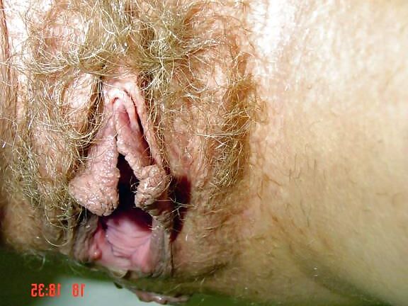 Exposed wifes stretched cunt