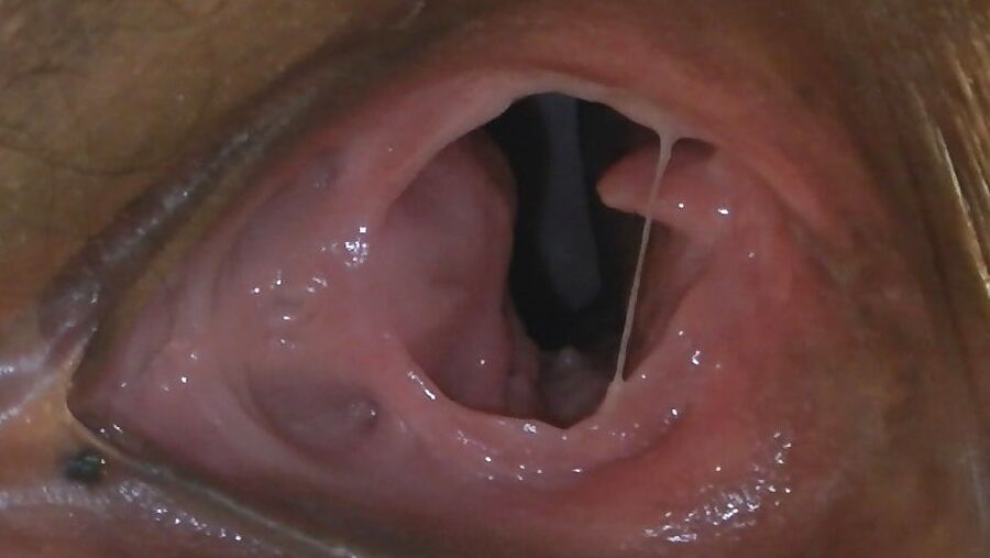 Gaping