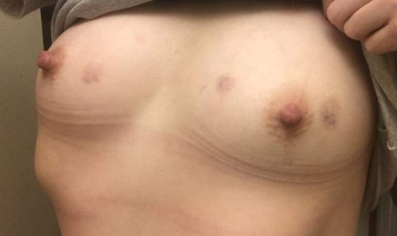 GF &amp; I
