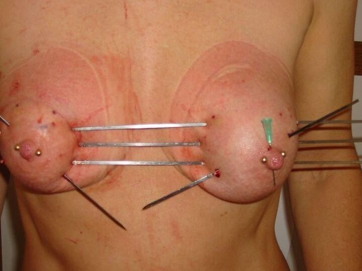 Needles