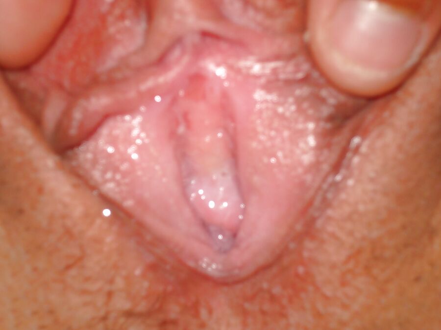 Asian wife pussy gaping and cervix exposure