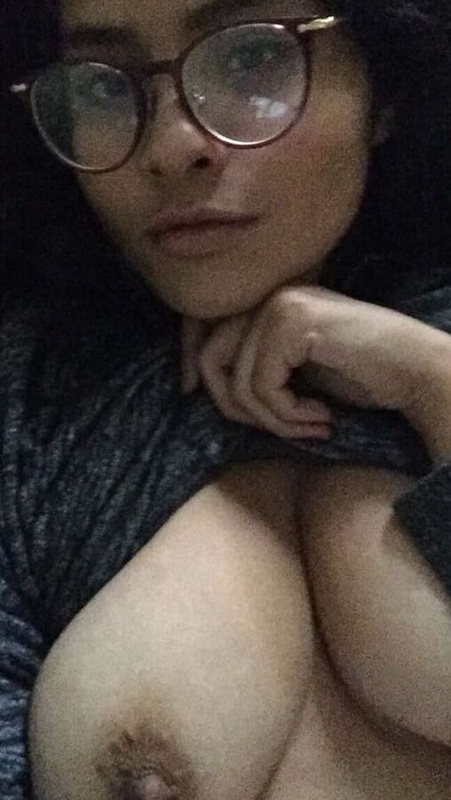 exposed