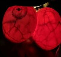 Breast transillumination test