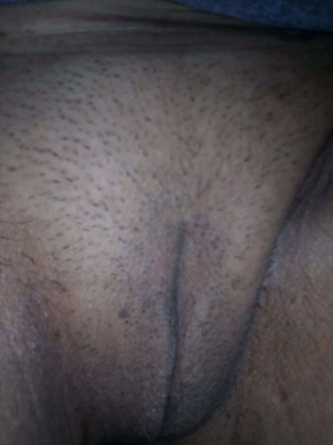 COROA BUCETUDA
