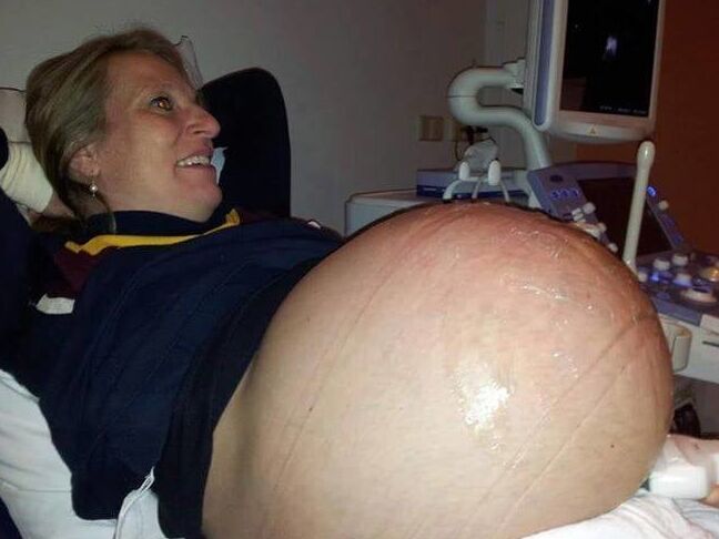 Pregnant