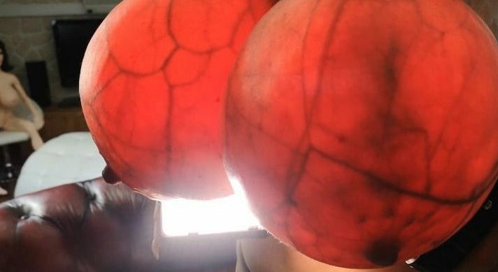 Breast transillumination test