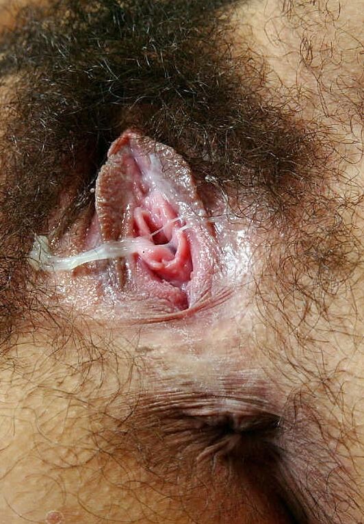 Hairy Pussy Discharge