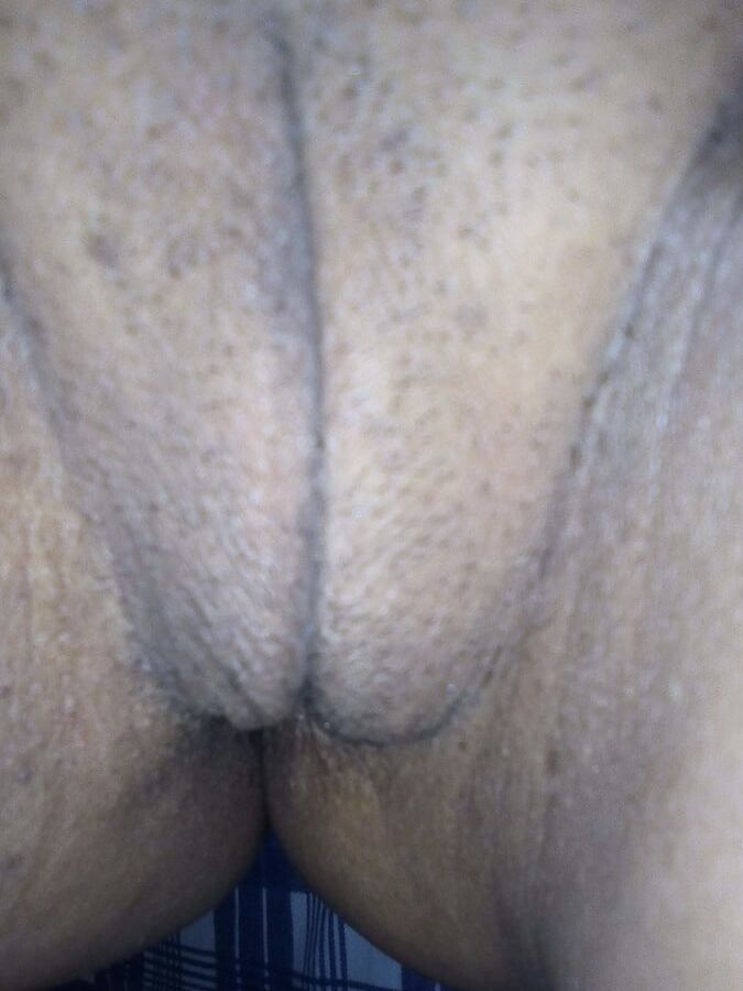 COROA BUCETUDA