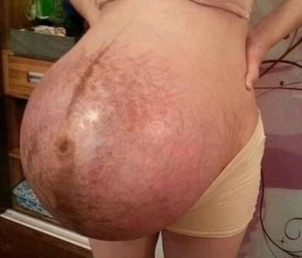 Pregnant