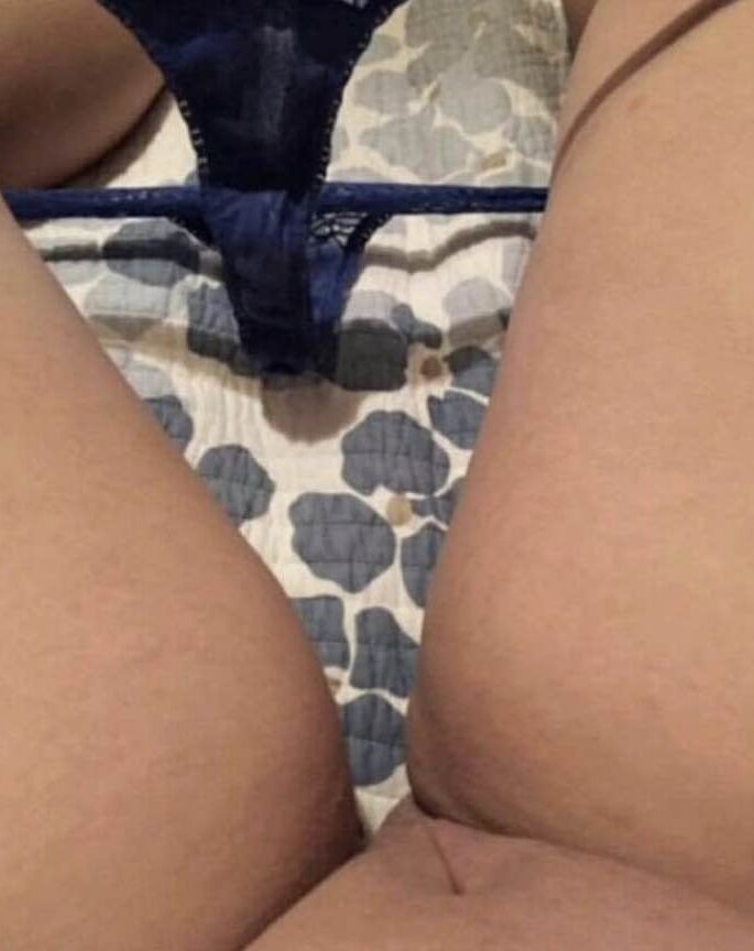 Lizzie&;s exposed body