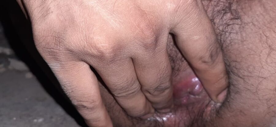Hairy ass