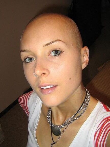 Bald head