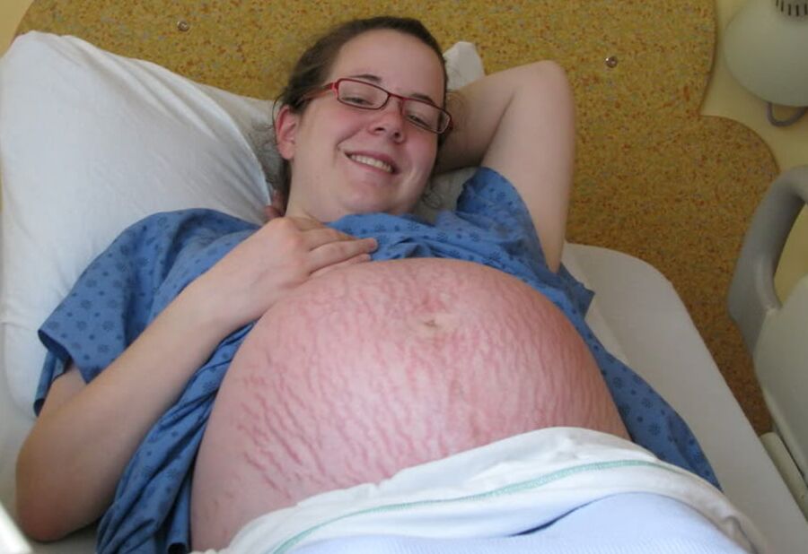 Mix pregntants - comment and rate