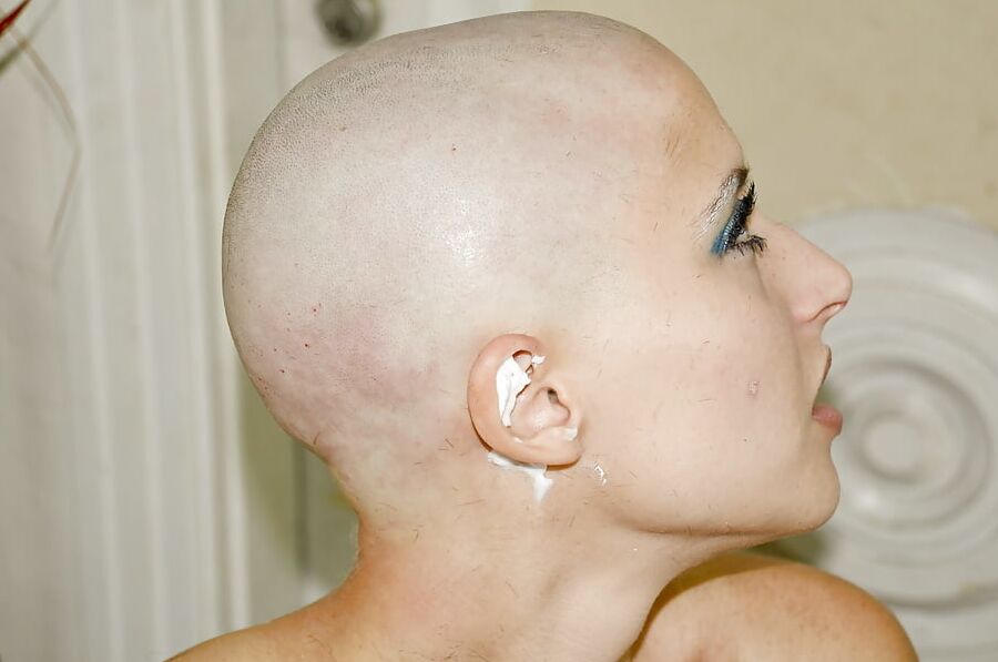 Bald head