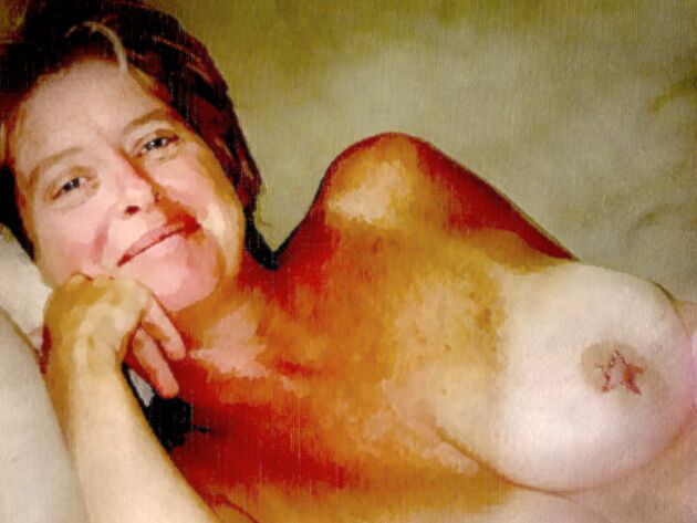 Breasts