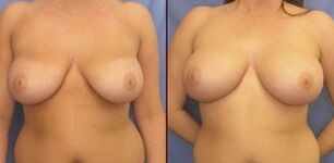 Great tits _