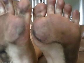 Dirty feet
