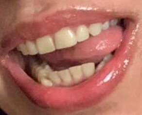 My first pictures