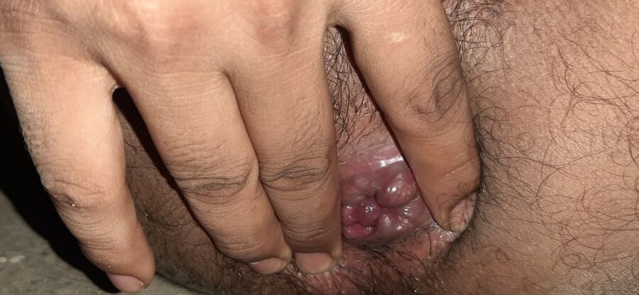 Hairy ass