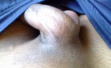 Stick