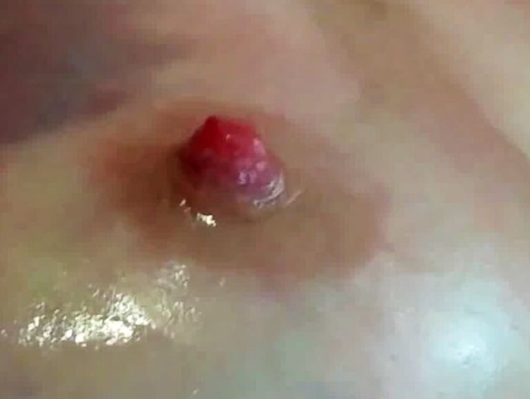 Cock Starter