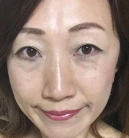 Lin Wong
