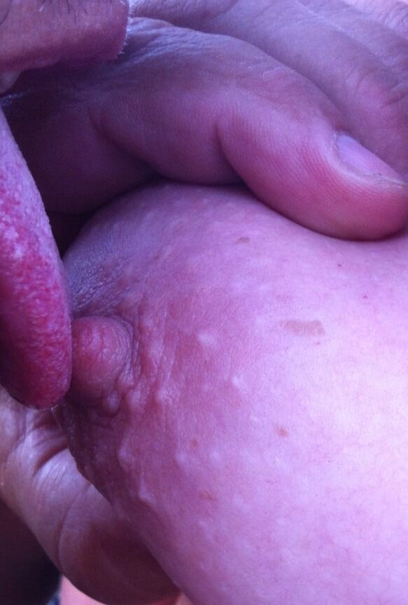 Nipples