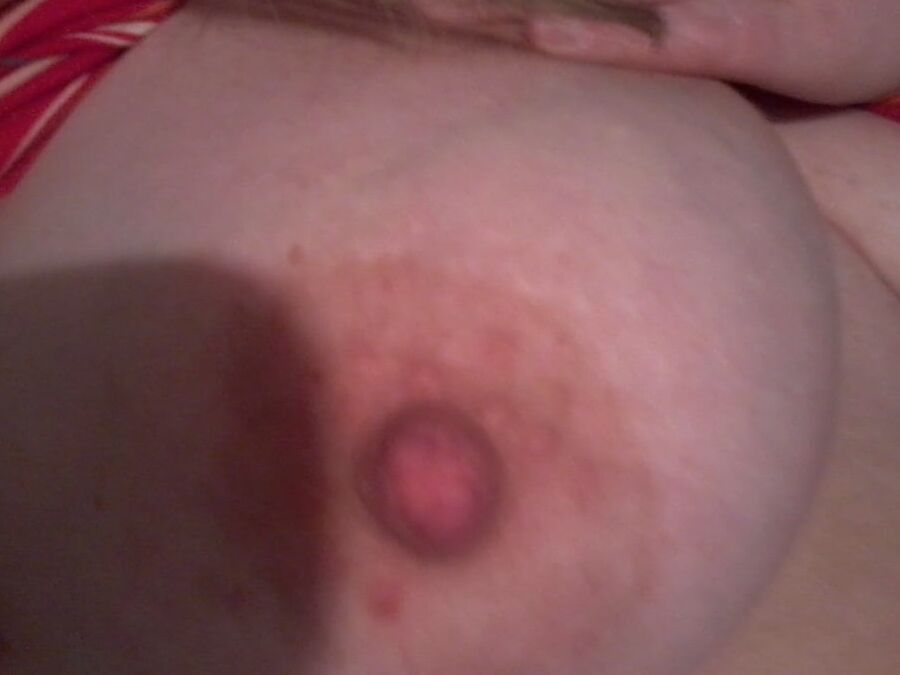 Nipples