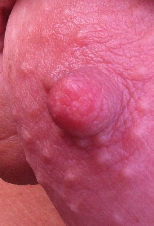 Nipples