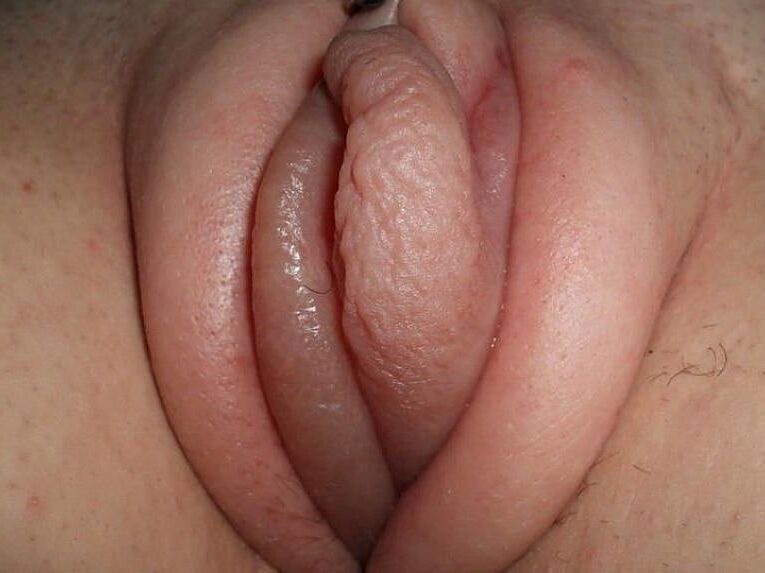 Puffed up plums