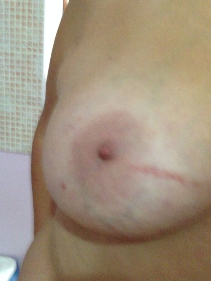 Nipples