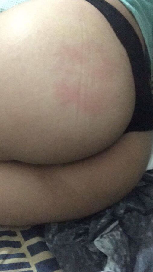 Tetas