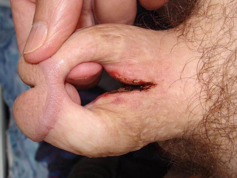 Weird Probing