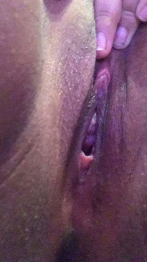 Tetas