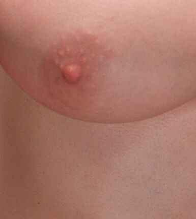 Nipples