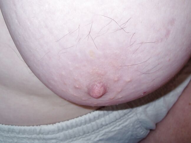 hairy nipples indian
