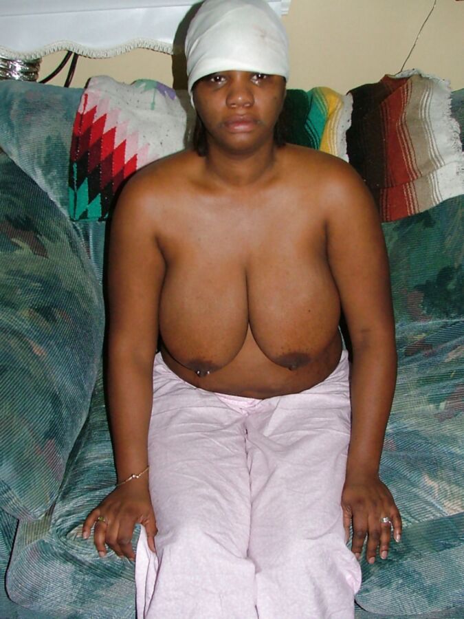 Nipples