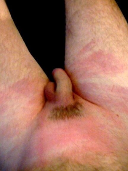 Slave rainer CBT