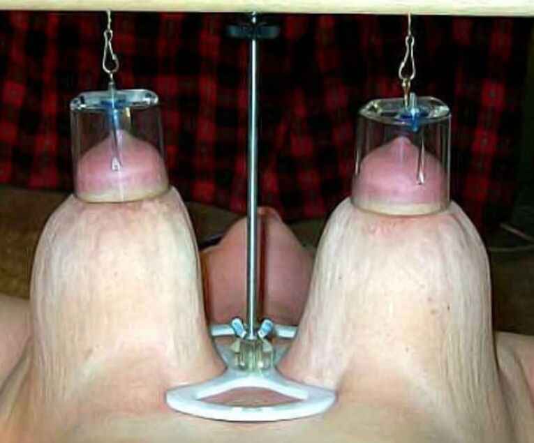 Breast pain